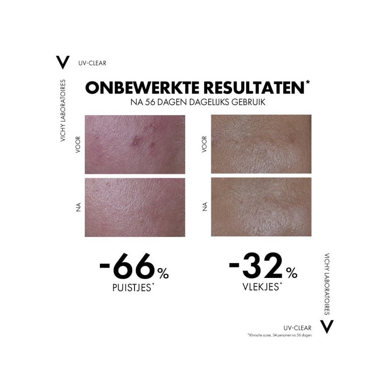 Capital Soleil UV Clear Anti-onzuiverheden zonnebrand voor het gezicht SPF50+ - 40ml-0