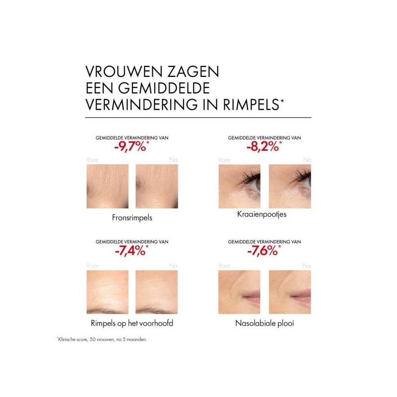 Liftactiv Retinol Specialist Serum - 30ml-0